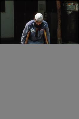 Amputee, Victim of Landmine, Kabul, Afghanistan